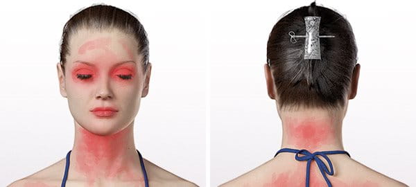 Важни зони за нанасяне на слънцезащита