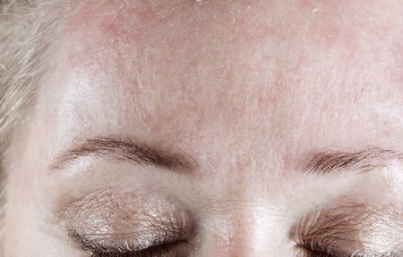 Челото на жена с оформени люспи