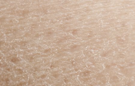 Изглед отблизо на суха кожа