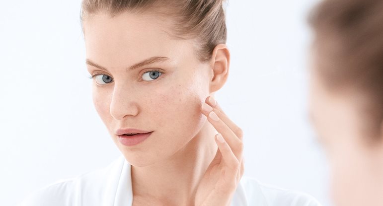 Pimples, blackheads and blemish-prone skin